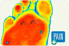 Foot evaluation
